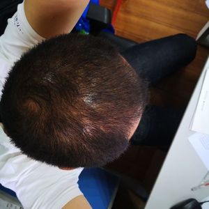 发际线分享社区