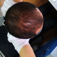 發(fā)際線用戶圖片