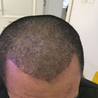 發(fā)際線用戶圖片