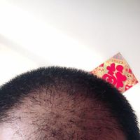 發(fā)際線用戶圖片