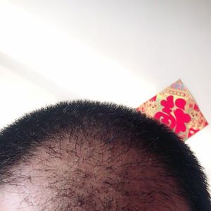 发际线分享社区