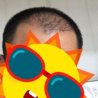 發(fā)際線用戶圖片