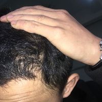 發(fā)際線用戶圖片