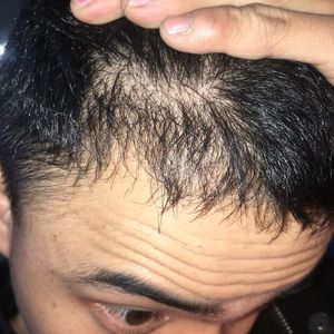 发际线分享社区