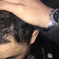 發(fā)際線用戶圖片