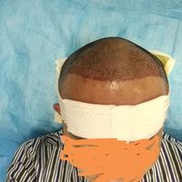 發(fā)際線用戶圖片
