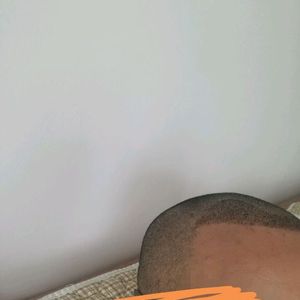 发际线分享社区