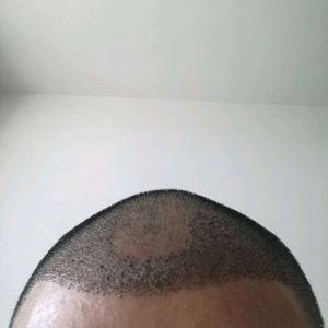 发际线分享社区