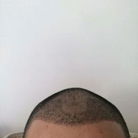 發(fā)際線用戶圖片