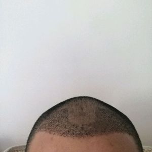 发际线分享社区