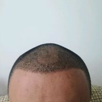 發(fā)際線用戶圖片