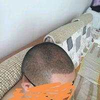 發(fā)際線用戶圖片