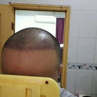 發(fā)際線用戶圖片