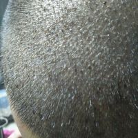 發(fā)際線用戶圖片