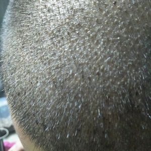 发际线分享社区