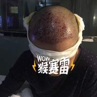 發(fā)際線用戶圖片