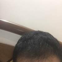 發(fā)際線用戶圖片