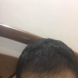 发际线分享社区