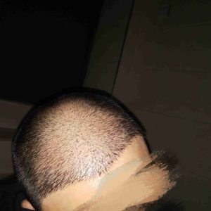发际线分享社区