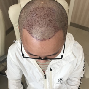 发际线分享社区