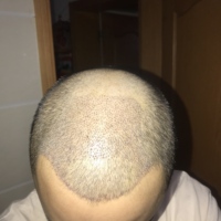 發(fā)際線用戶圖片