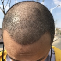 發(fā)際線用戶圖片