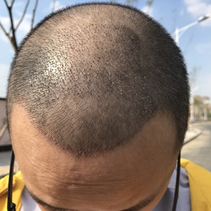 发际线分享社区