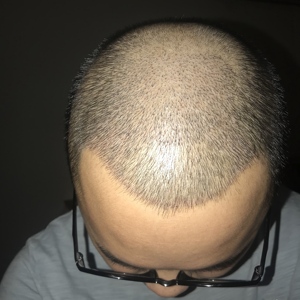 发际线分享社区