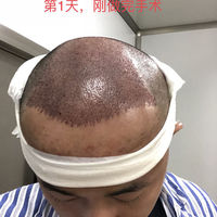 發(fā)際線用戶圖片