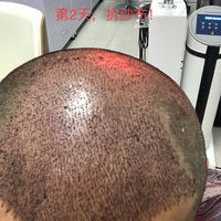 發(fā)際線用戶圖片
