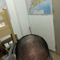 發(fā)際線用戶圖片