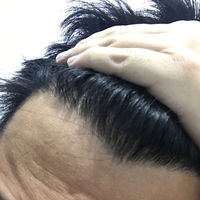 發(fā)際線用戶圖片