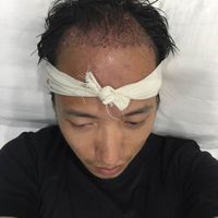發(fā)際線用戶圖片