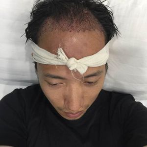 发际线分享社区