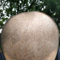 發(fā)際線用戶圖片