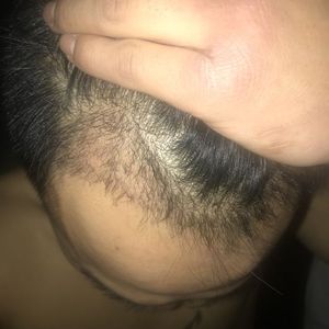 发际线分享社区
