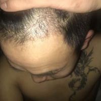 發(fā)際線用戶圖片
