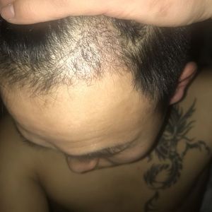发际线分享社区