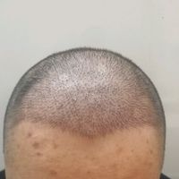 發(fā)際線用戶圖片