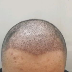 发际线分享社区