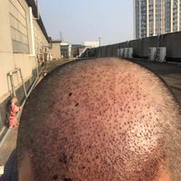 發(fā)際線用戶圖片