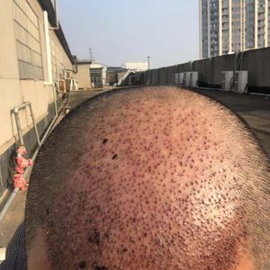 发际线分享社区