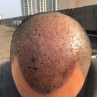 發(fā)際線用戶圖片