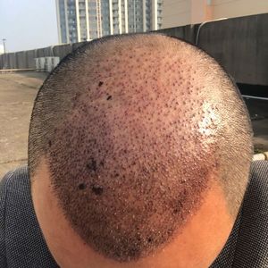 发际线分享社区