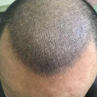 發(fā)際線用戶圖片