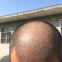 發(fā)際線用戶圖片