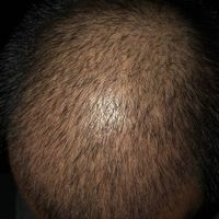 發(fā)際線用戶圖片