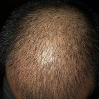 發(fā)際線用戶圖片