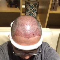 禿頂用戶圖片