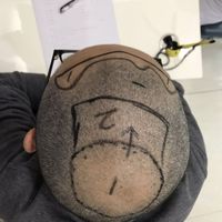 禿頂用戶圖片